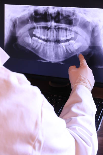 Best Emergency Denture Repair in Frankfort, OH